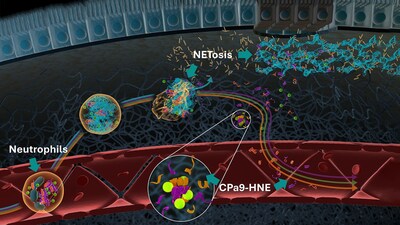 Nordic Bioscience、炎症性腸疾患の CPa9-HNE バイオマーカーについて FDA から支持書を受け取る