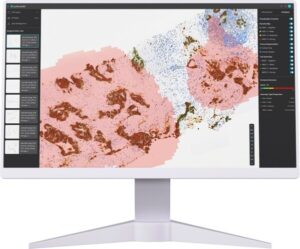 Lunit AI Enhances Precision in Predicting Outcomes for HER2-Targeted Therapy in Metastatic Colorectal Cancer - new study published in JCO Precision Oncology