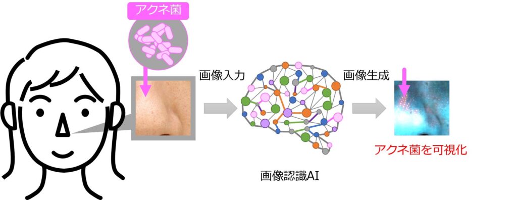 画像認識AI（※1）でニキビの原因菌（※2）を可視化する新技術を開発！～毎日のニキビ予防ケアの効果実感向上を目指す～