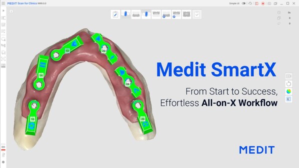 オールオンXに革命を起こす：Meditのワークフローがゲーム・チェンジャーとなる