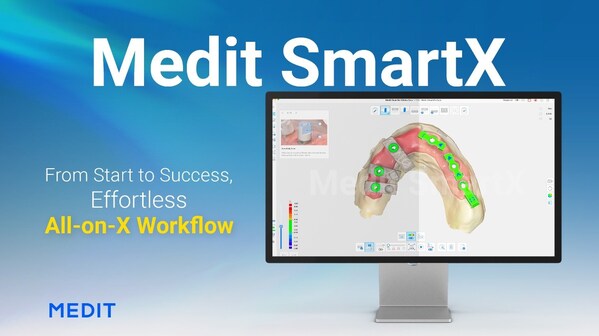 Medit、新たなAll-on-Xソリューション「Medit SmartX」を発売