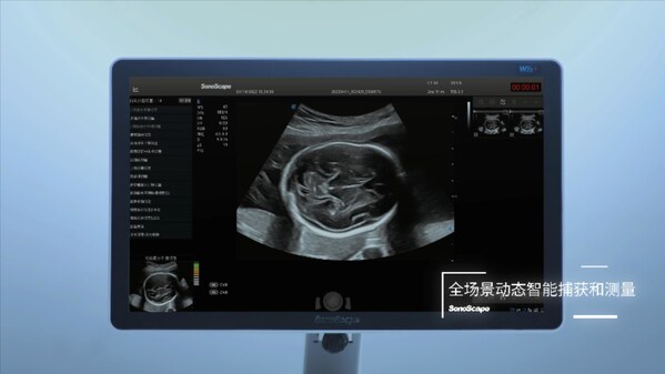 开立医疗获得国内首个产前超声人工智能医疗器械证