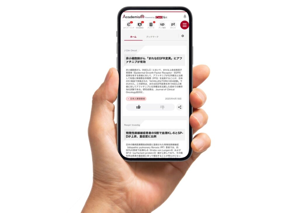 ケアネット、AI搭載の新サービス『CareNet Academia』開始