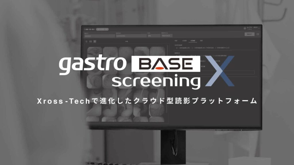 【新製品】がん見逃しゼロを目指すAIメディカルサービス、対策型胃がん検診および対策型肺がん検診において医師および運用上の負担を軽減するクラウド型読影プラットフォームの製造販売認証を取得