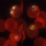 「AIを活用した Cell Painting アッセイによる抗マラリア化合物作用機序解析プラットフォームの開発」がGHIT Fundに採択