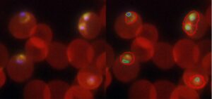 「AIを活用した Cell Painting アッセイによる抗マラリア化合物作用機序解析プラットフォームの開発」がGHIT Fundに採択