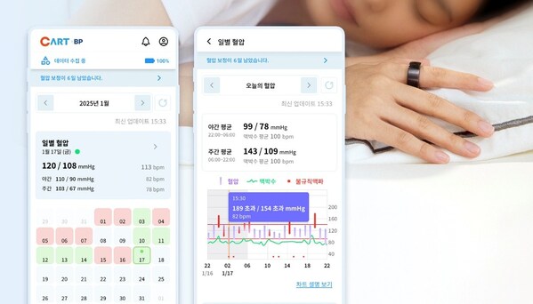 Sky Labs、リング型カフレス血圧計「CART BP」を発売