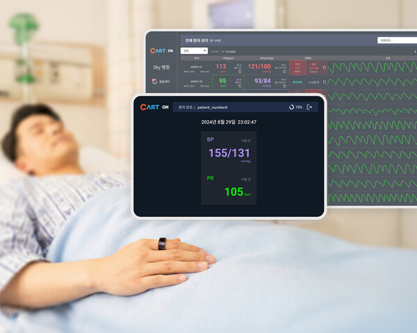 Sky Labs社、世界初の病棟向けリング型ウェアラブル血圧モニタリング・ソリューション「CART ON」発売