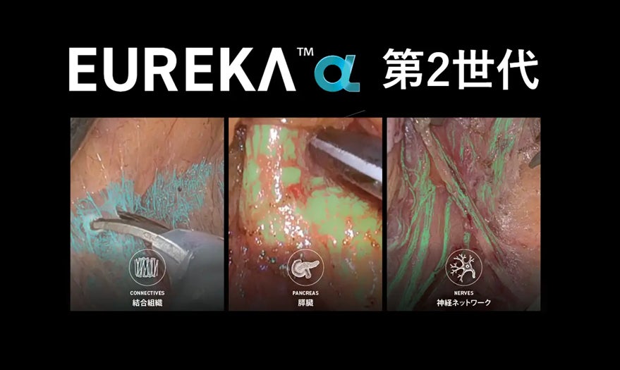 アナウト株式会社、手術室のAI基盤として、「EUREKA Inside」事業を開始